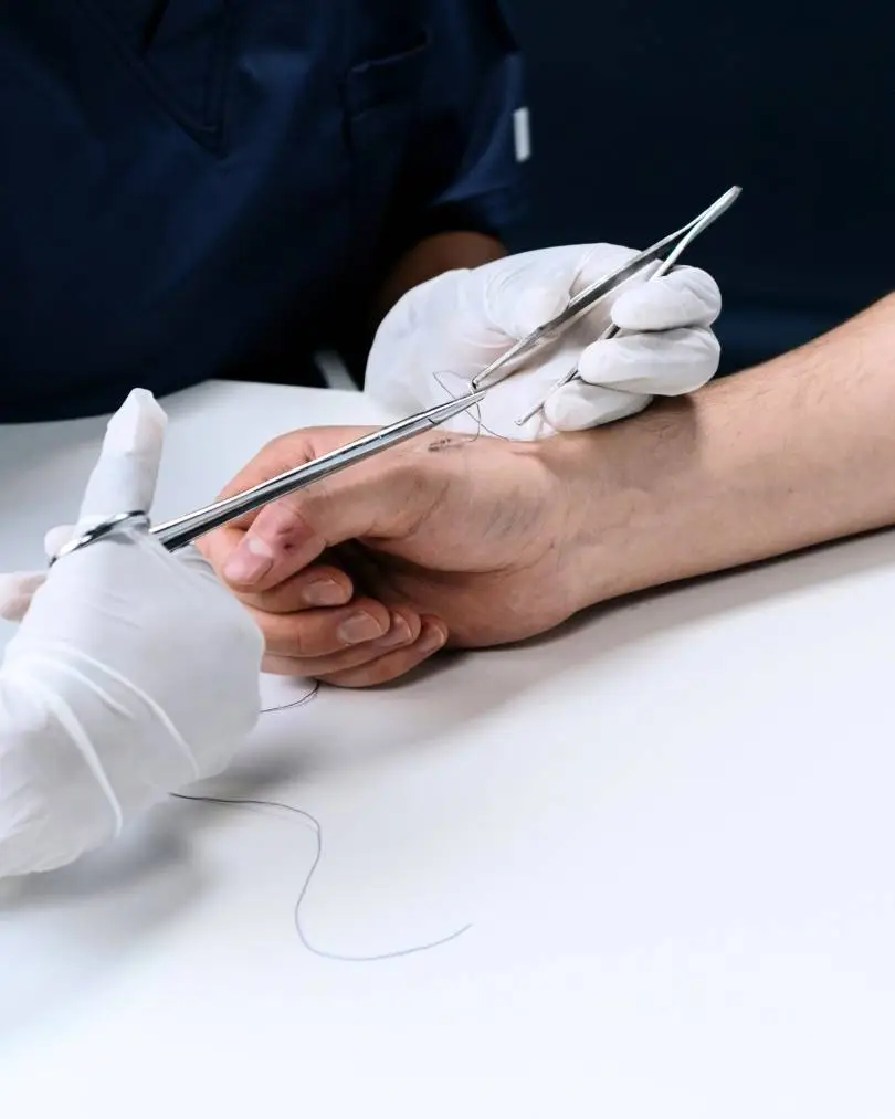 infirmier points suture
